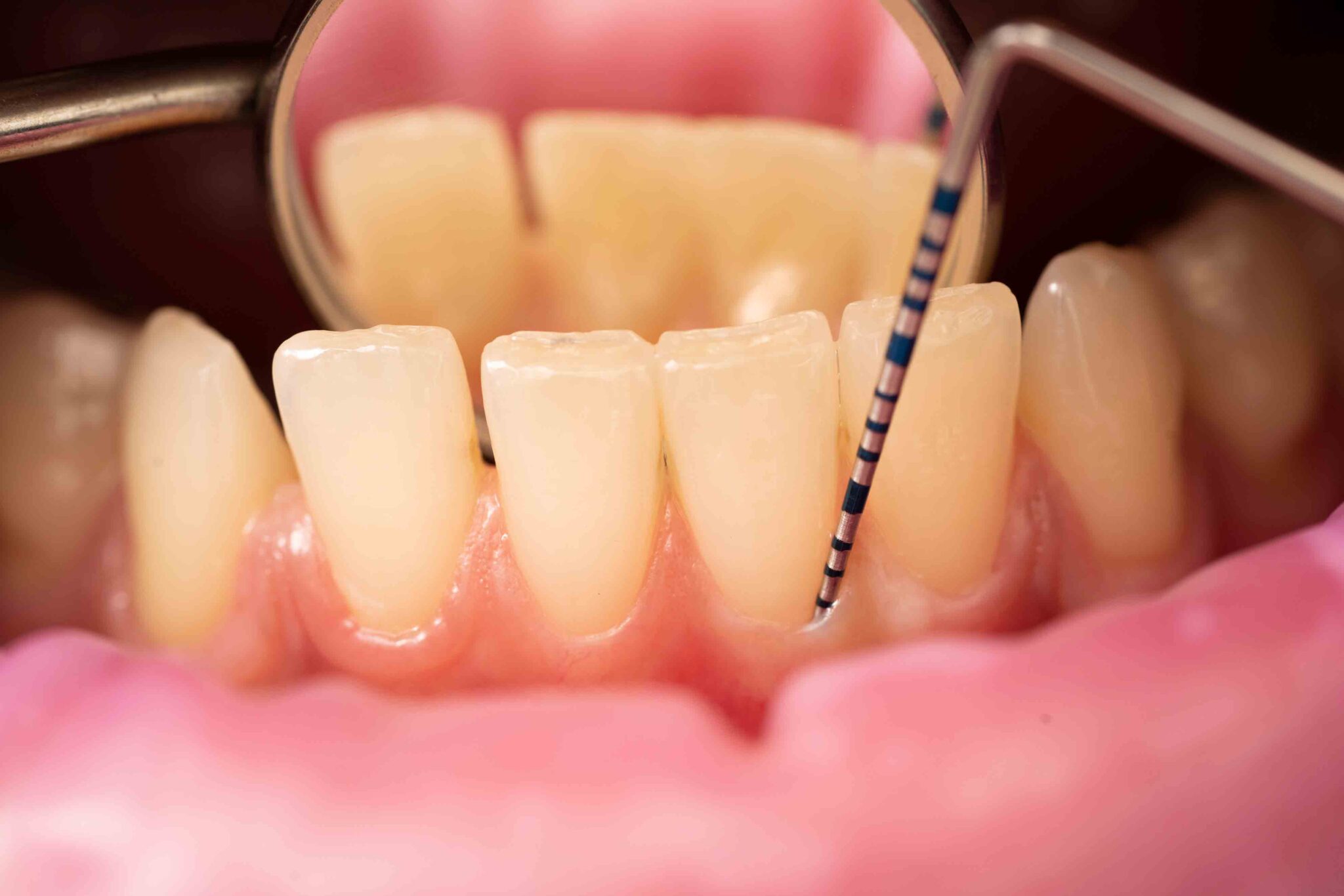Mini Dental Implant Center