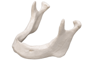 Bone Loss Stage 1