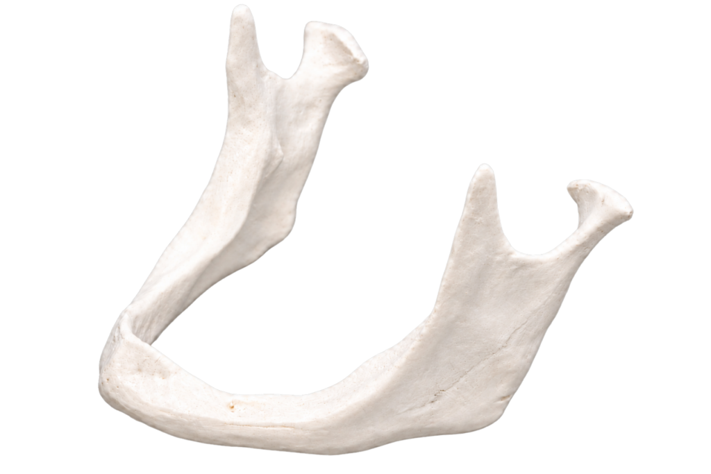 Bone Loss Stage 4