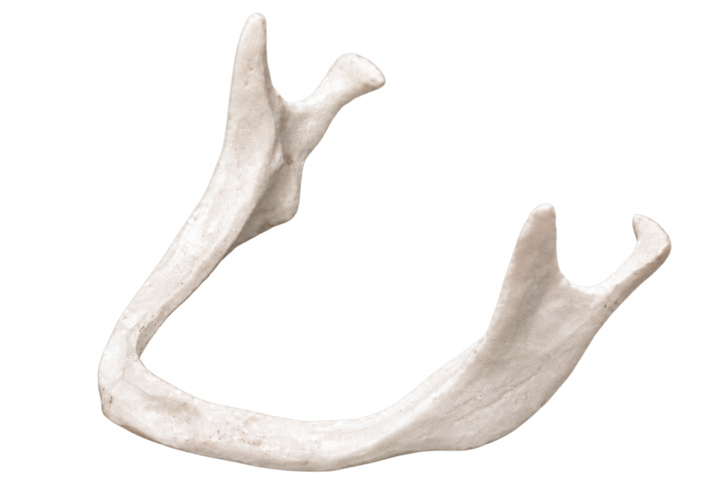 Bone Loss Stage 5