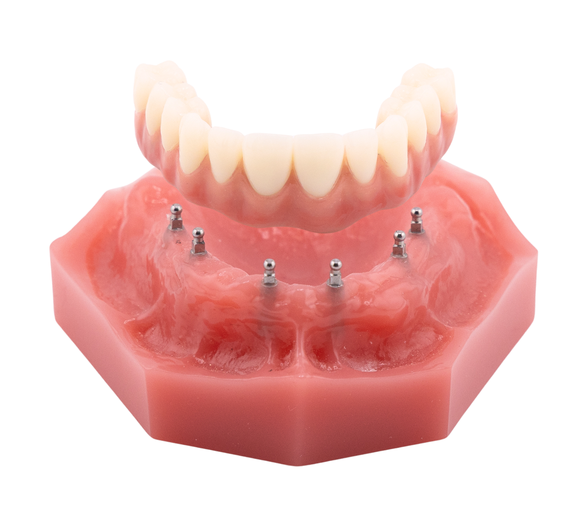Mini Dental Implant Center