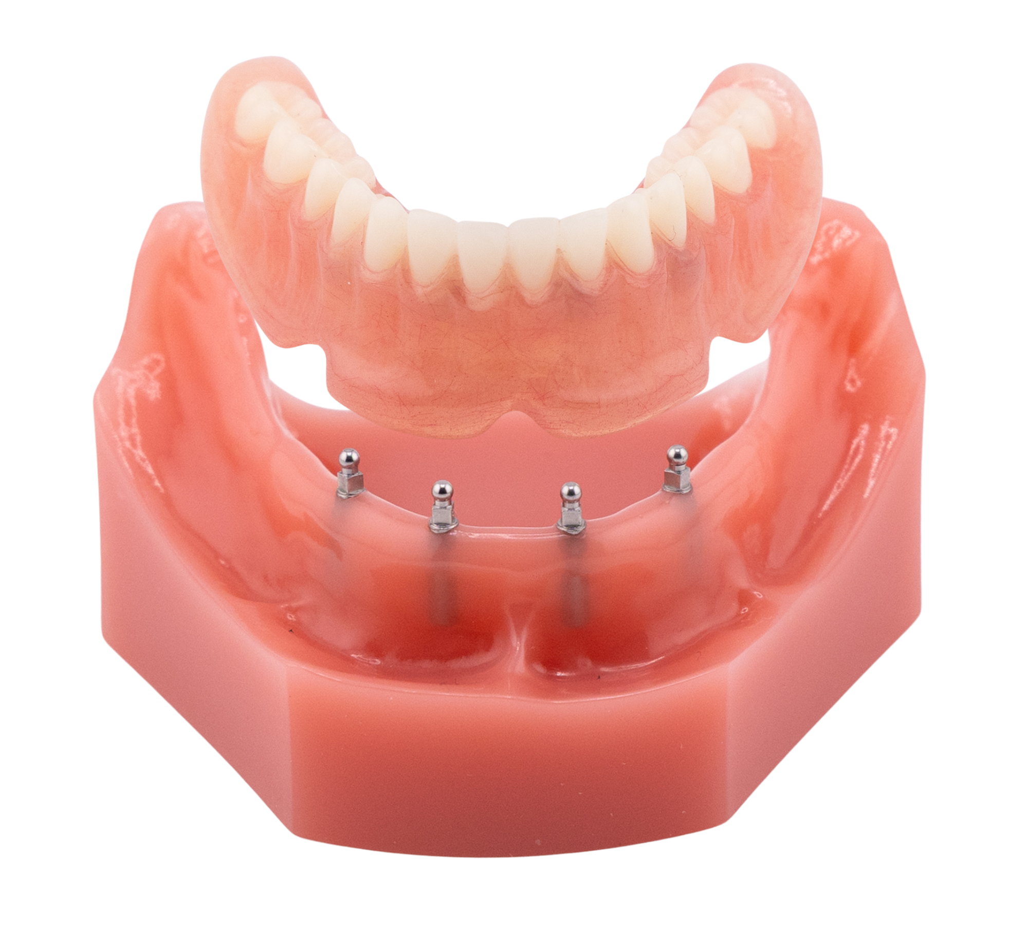 Mini Dental Implant Center